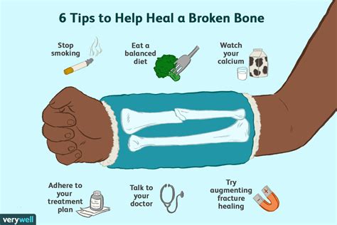 Bone Healing After Fracture