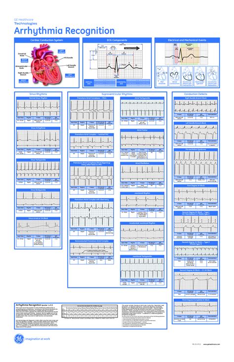 Dysrhythmia Interpretation Critical Care Nursing Nursing School