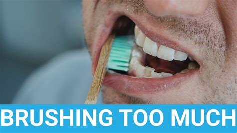 Can You Brush Your Teeth Too Much YouTube