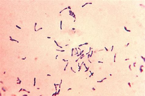 Bacterial Infectious Diseases From Gram Positive Rod Bacteria