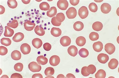 Red Blood Cells And Platelets Lm Stock Image C0222233 Science
