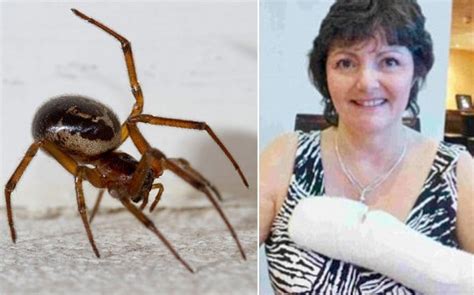 Woman Nearly Lost Arm After Black Widow Spider Bite