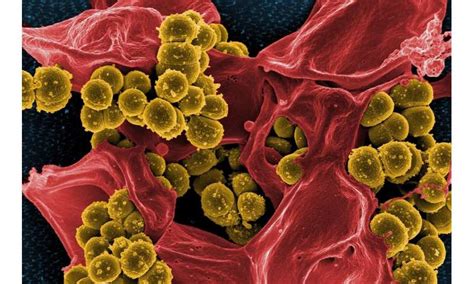 First Proof A Synthesized Antibiotic Is Capable Of Treating Superbugs