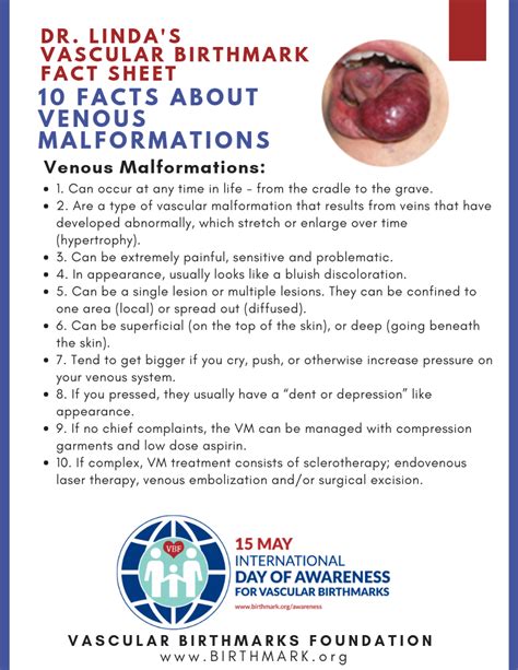 Venous Malformation Vascular Birthmarks Foundation