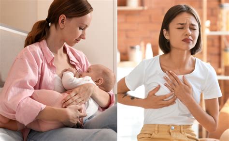 Breast Engorgement Causes Symptoms And Relief Strategies