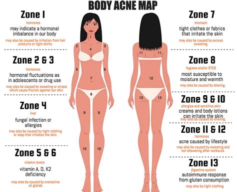What Your Acne Map Is Telling You The Chalkboard