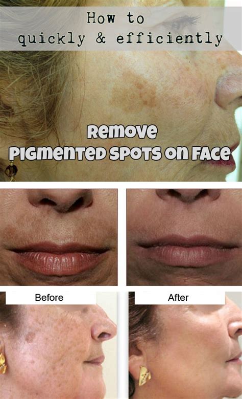 In this article, we will be going to introduce you how to remove dark or black spots on face: Most Creative and Life-changing Beauty Hacks Every Woman ...