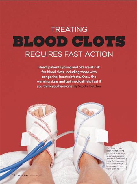 Treating Blood Clots Requires Fast Action Mended Hearts