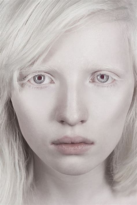 russian albino model nastya kumarova Альбинизм Лицо Портрет