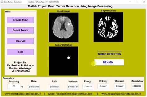 Matlab Code For Brain Tumor Detection And Classification Using Image