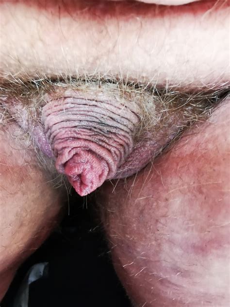 Worlds Smallest Dick Porn Pictures Xxx Photos Sex Images 4052268 Pictoa