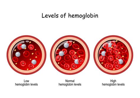 Hemoglobin Levels In Pregnant Women Natural Ways To Up Your Platelet