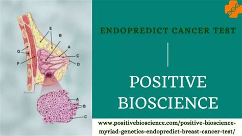 Ppt Endopredict Cancer Test Best Treatment Help Most Accurate