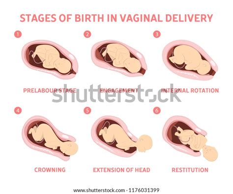 Stages Baby Birth Vaginal Delivery Fetus Stock Vector Royalty Free