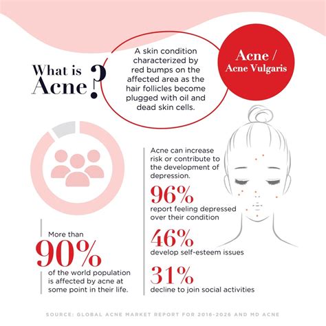 Types Of Acne Causes And Treatment Infographic Tips For Natural
