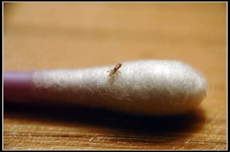 Effective and Natural Lice Treatments