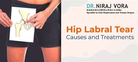 Hip Labral Tear Symptoms Causes And Treatments Dr Niraj Vora Dr