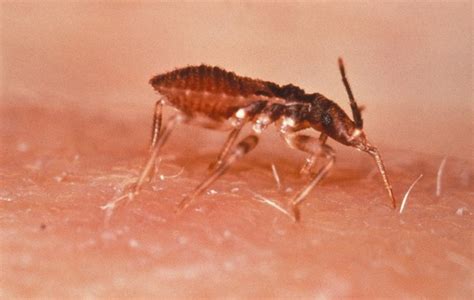 Kissing Bug Spreading Tropical Disease In Us Video Canada Journal