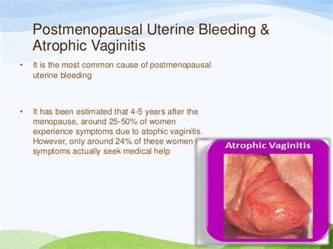 Atrophic Vaginitis As Related To Bleeding Pictures