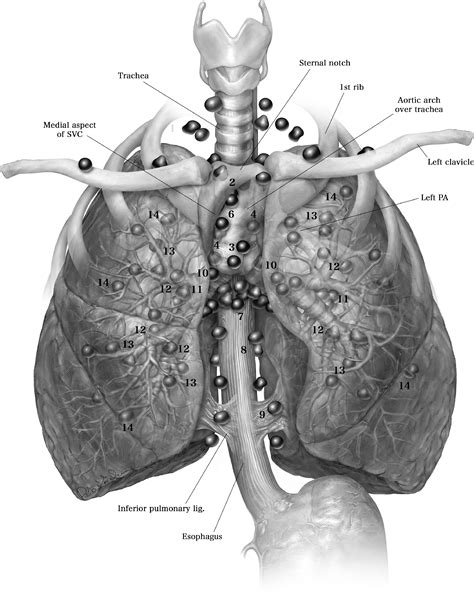 Mediastinal Lymph Node Stations Radiographics News Current Station In
