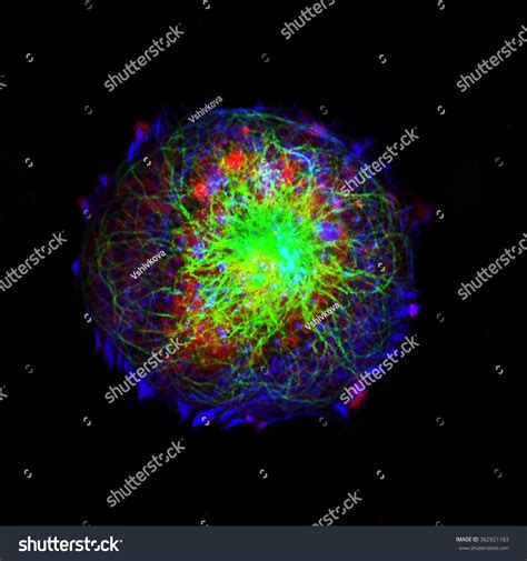Real Fluorescence Microscopic View Human Neuroblastoma Stock Photo