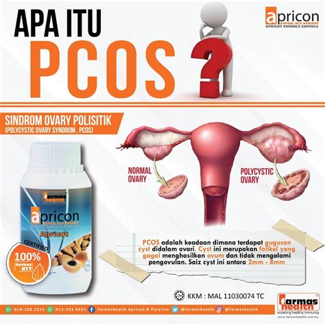Apa itu ovarian cyst dan apa cara rawatan selain pembedahan? APA ITU PCOS?🤔🧐😱 | Pcos, Digital marketing, Marketing