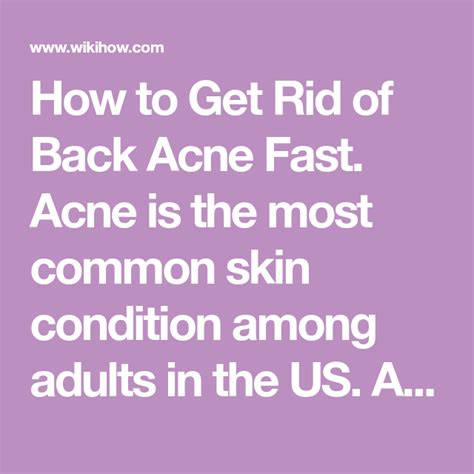How To Get Rid Of Back Acne Fast Acne Is The Most Common Skin