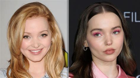 Did Dove Cameron Get Plastic Surgery Then And Now Photos