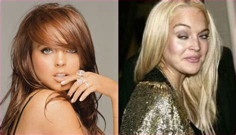 Top 10 Botched Female Celebrities Who Became Unrecognizable To The