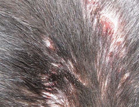 Ringworm In Dogs Symptoms Treatment At Home
