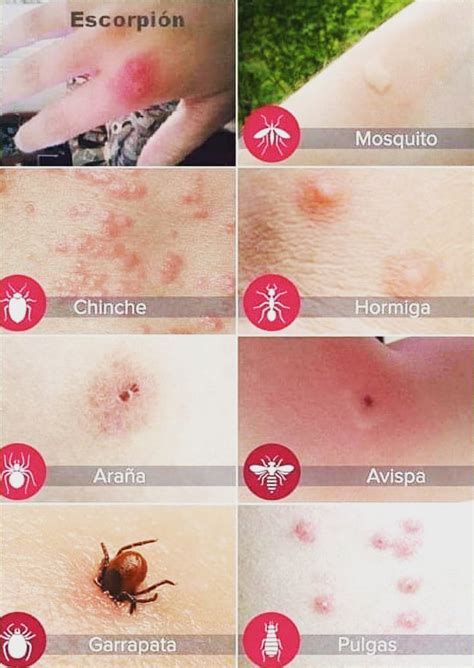 Cómo evitar las picaduras de mosquitos mantén a raya a los insectos que pican