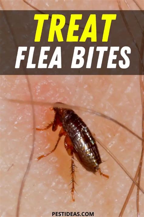 How To Treat Flea Bites Get Rid Of Fleas