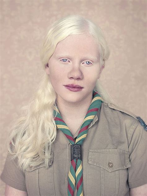 Beautiful Portraits Of Albinos By Gustavo Lacerda Albino Girl