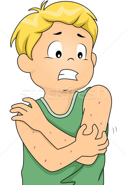 1400 Itchy Skin Illustrations Royalty Free Vector Graphics Clip