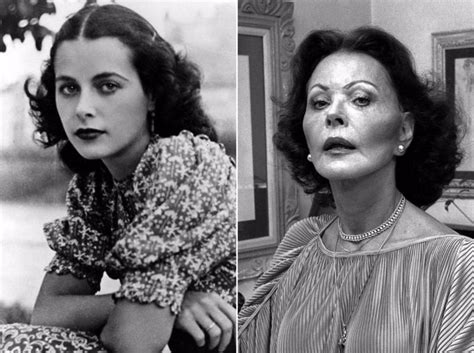 11 Classic Hollywood Stars Who Had Plastic Surgery Vintage Everyday