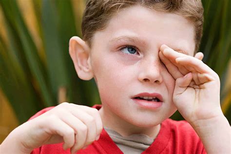 Allergies And Children Eye Health Library Bc Doctors Of Optometry