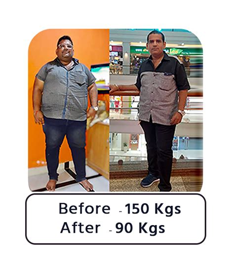 Bariatric Surgery Before And After Success Story Dr Manish Motwani