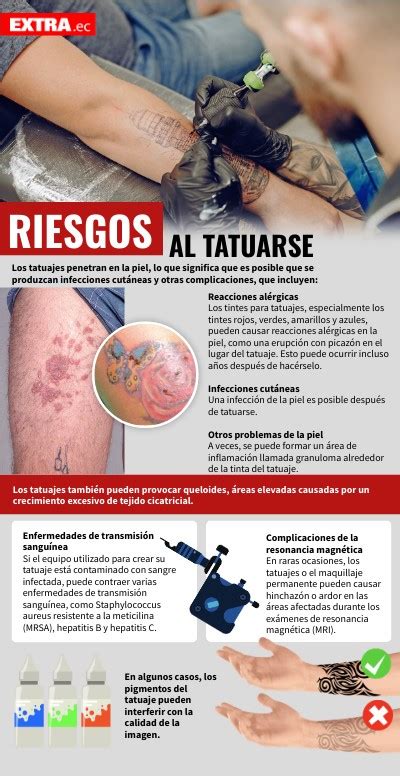 Top Imagem Enfermedades De La Piel Por Tatuajes Thptletrongtan Edu Vn