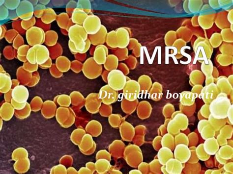 Mrsa Ppt