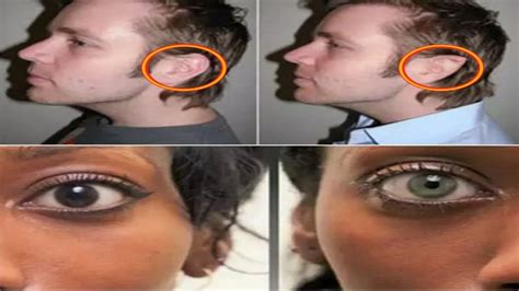 Bizarre Plastic Surgeries You Didnt Know About Cosmetic Surgery