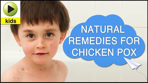 Kids Health Chicken Pox Natural Home Remedies For Chicken Pox Youtube