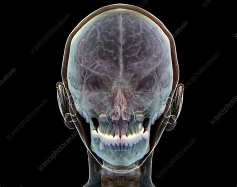 Normal Human Brain 3d Ct Scan Stock Image C0472019 Science