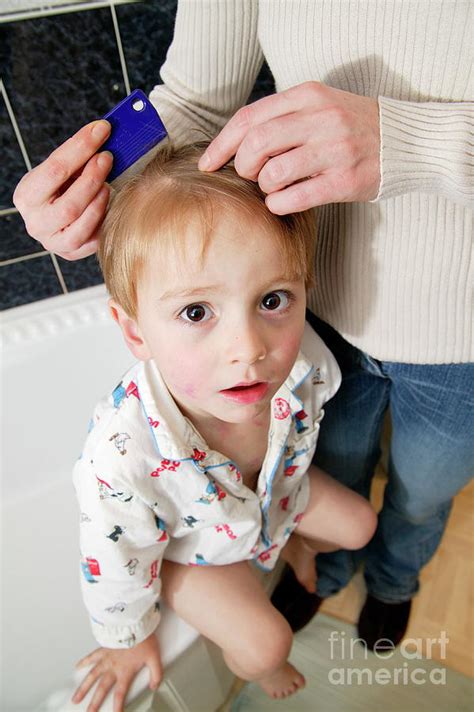 Head Lice Combing Photograph By Michael Donnescience Photo Library