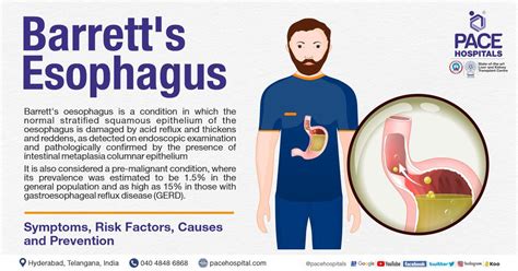 Barretts Esophagus Symptoms Causes Types And Complications