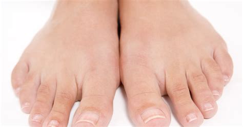 How To Get Rid Of Thick Skin Under The Toenails Livestrongcom