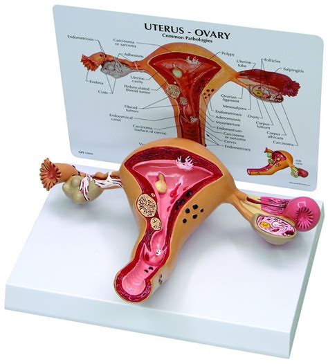 In terms of comparative anatomy the human scapula represents two bones that have become fused together. Uterus and Ovary Anatomy Model With Pathologies | Anatomy models, Uterus, Human body anatomy