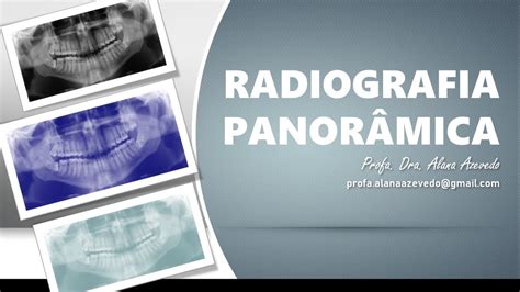Aula Radiografia Panor Mica Youtube