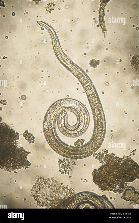 Trichinella Spiralis Parasitic Nematoda Worm Microscope Stock Photo