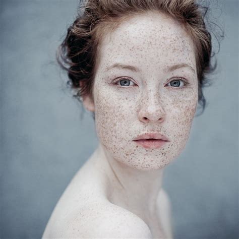 Charming Photographs Of Freckles Freckes Redheads Beautiful