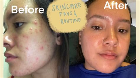 Skincare Favorites And Routine I Fungal Acne Safe Youtube